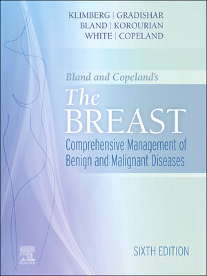 cover image of The Breast--E-Book